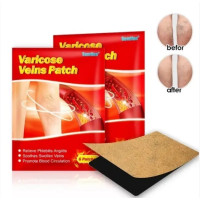 Пластырь от варикоза Varicose Veins Medical (1000)