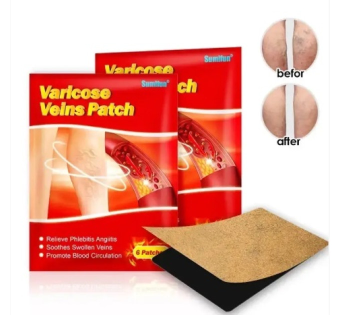 Пластырь от варикоза Varicose Veins Medical (1000)